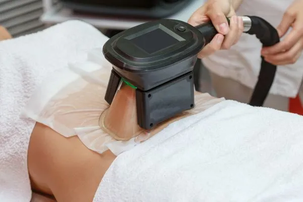 Image of person having fat freezing treatment to help weight gain Bedford