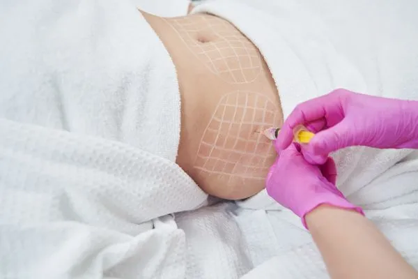 image of fat dissolving injections on love handles to help combat weight gain Bedford