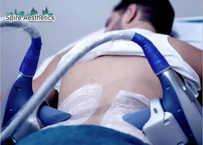 Man having fat freezing treatment done on love handles before a competitions Bedford to create a sculpted look.