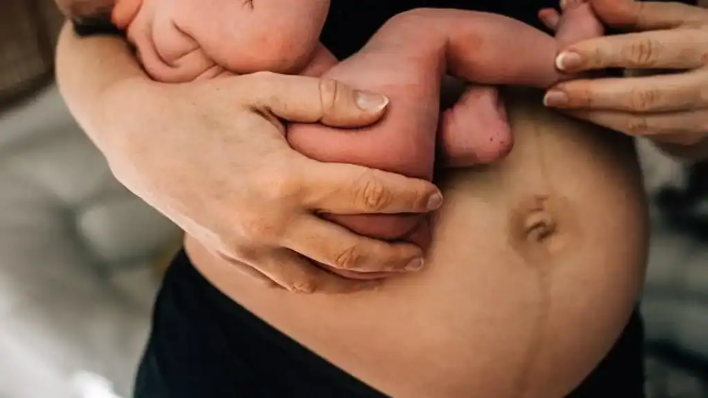 Why Is My Stomach Still Big After Pregnancy Bedford?