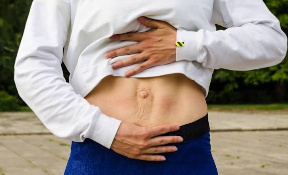 When Could Diastasis Recti Be the Missing Piece of the Puzzle Bedford?
